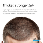 Alpha Hair Loss Prevention Lotion for Men